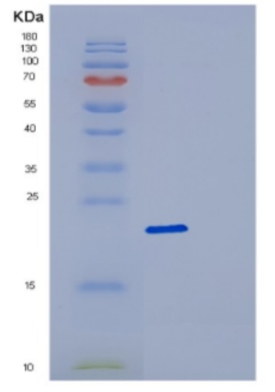 Recombinant Human DCTD Protein