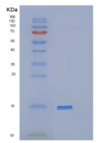 Recombinant Human DDT Protein