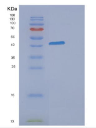 Recombinant Human DHODH Protein