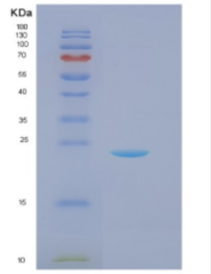 Recombinant Recombinant DJ-1(PARK7) Protein