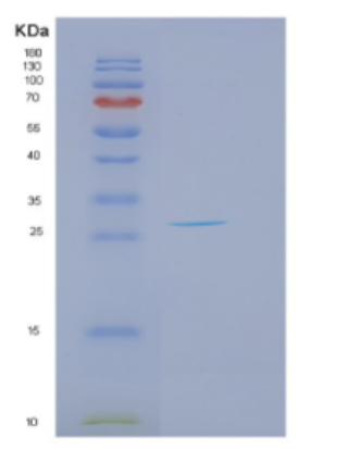 Recombinant Human DKK2 Protein