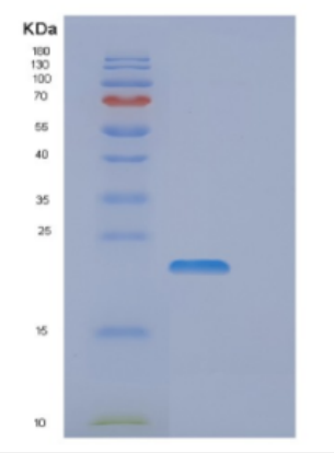 Recombinant Human DLX3 Protein