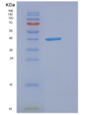 Recombinant Human DNAJB11 Protein