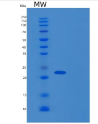 Recombinant Human DCTN6 Protein