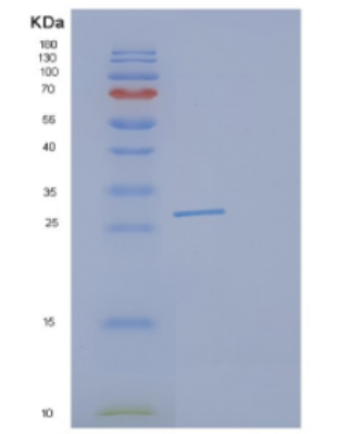 Recombinant Human DCXR Protein