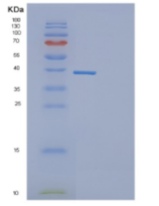 Recombinant Human DEDD Protein