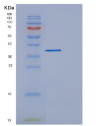 Recombinant Human DFFA Protein