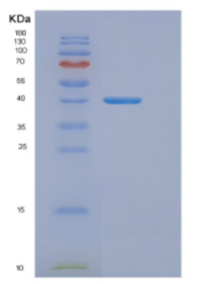 Recombinant E.coli DnaJ (Amino acids 1-376) Protein