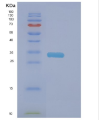 Recombinant Human DNAJC27 Protein