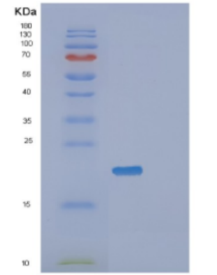 Recombinant Human Diamine N-acetyltransferase 1 Protein