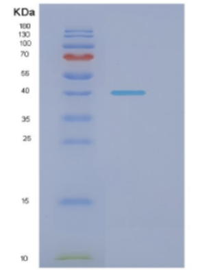 Recombinant E.coli Dnak(N-term;1-384) Protein