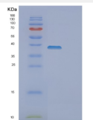 Recombinant Human DOK4 Protein