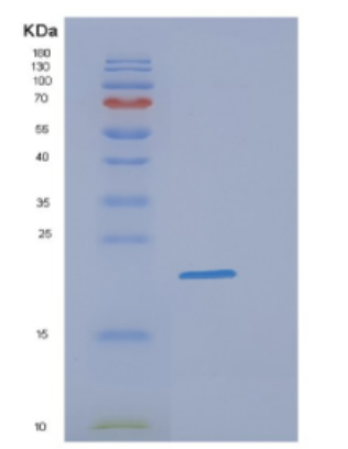 Recombinant Human DHH Protein