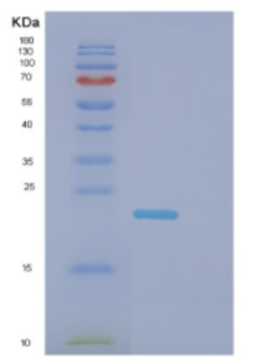 Recombinant Human DNAL1 Protein