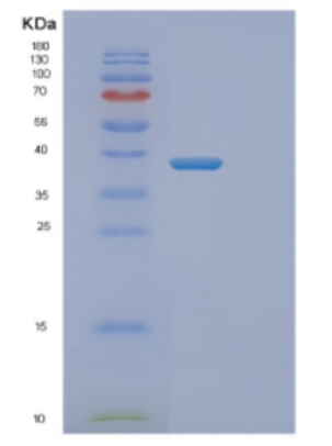 Recombinant Human DNTTIP1 Protein