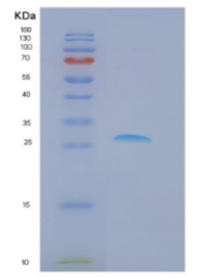 Recombinant Human Dkk-1 Protein