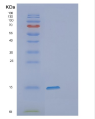 Recombinant Human DPPA5 Protein