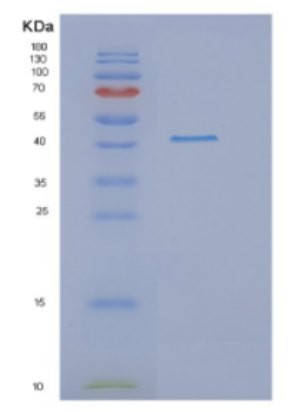 Recombinant Human DRG1 Protein