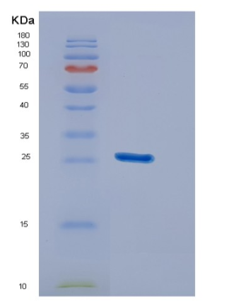 Recombinant Human DUSP26 Protein