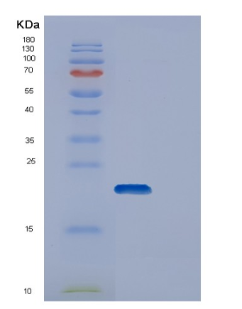 Recombinant Human DUT Protein