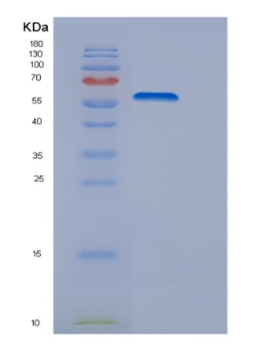 Recombinant Human DRS (Aspartyl-tRNA synthetase) Protein