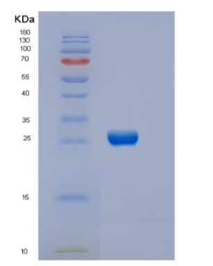 Recombinant Human DTYMK Protein