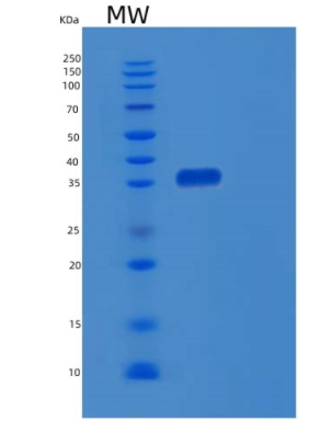 Recombinant Human EBNA1BP2 Protein