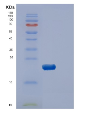 Recombinant Human DUSP3 Protein