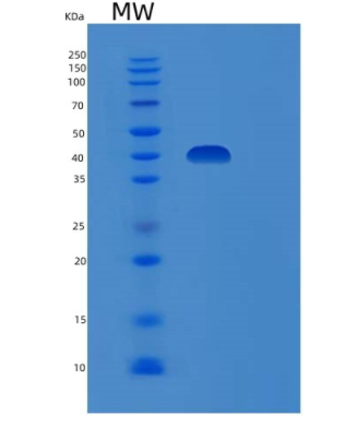 Recombinant Human DUSP6 Protein