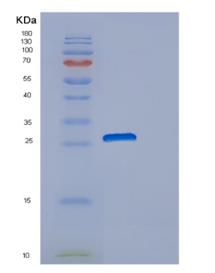 Recombinant Human DNAJB8 Protein
