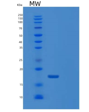 Recombinant Human DUSP23 Protein