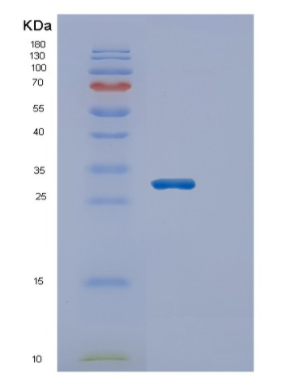 Recombinant Human ECHS1 Protein