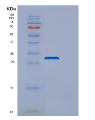 Recombinant Human ECI1 Protein
