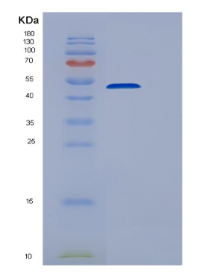 Recombinant Human EEF1G Protein