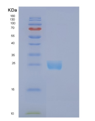 Recombinant Human EFNB1 Protein