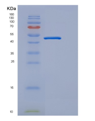 Recombinant Human EDAR Protein