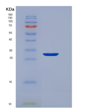 Recombinant Human EEF1D Protein