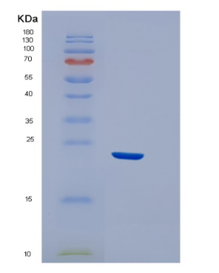 Recombinant Human EFNA3 Protein