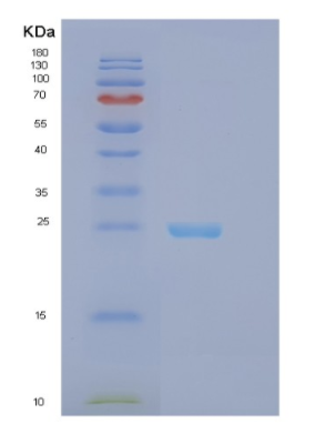 Recombinant Human EFNB3 Protein