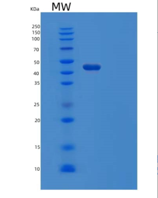 Recombinant Human EFNA5 Protein