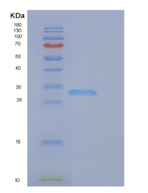 Recombinant Human EGLN3 Protein