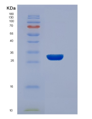Recombinant Human EEF1B2 Protein