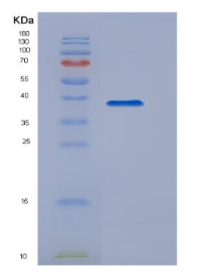 Recombinant Epidermal Growth Factor (EGF)