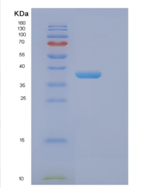 Recombinant Human EIF2S1 Protein