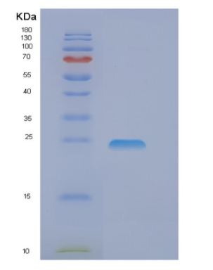 Recombinant Human EIF3J Protein