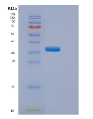 Recombinant Human ELP5 Protein
