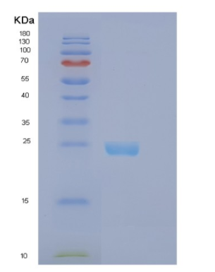 Recombinant Human EFNB2 Protein