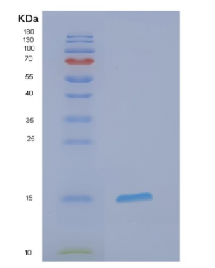 Recombinant Human EIF1B Protein