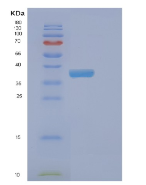 Recombinant Human EHF Protein