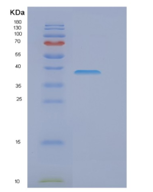 Recombinant Human EIF3I Protein